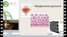 Кульченко Н.Г. - Лечение лучевых поражений мочевого пузыря